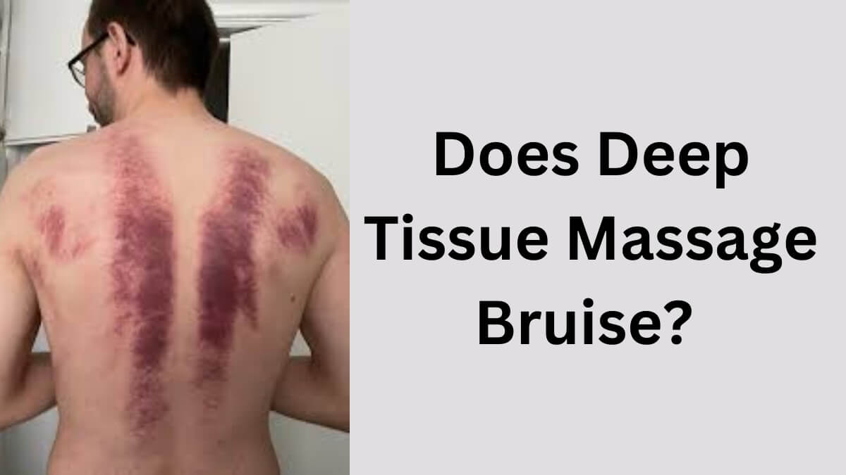 Does Deep Tissue Massage Bruise